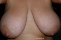 Busty Breast Reductions - Set 05 - N